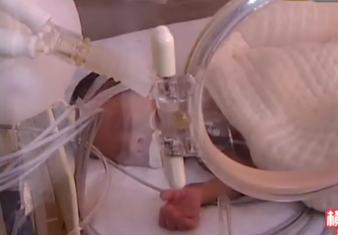SENZACIONALNO: Kako se beba vratila živa iz mrtvačnice nakon 15 sati u hladnjaku